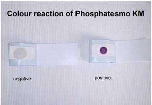 Sperma-Testpapier Phosphatesmo KM zum Nachweis der sauren Phosphatase, Dose a 2 Testpapiere 15 x 30 mm, 14 Stck an Lager