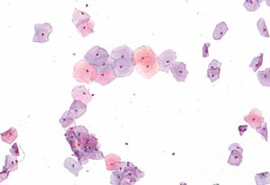 Frbekit: PAP / PAPANICOLAOU fr Abstrichprparate mit allen bentigten Reagenzien zur Verwendung in der Histologie und/oder Zytologie zum Frben von Abstrichprparaten</p>Staining kit: PAP / PAPANICOLAOU for smear preparations with all reagents required for use in histology and / or cytology for the staining of smear preparations</p>Laborbedarf,Frbung,Frbekits,Frbekit PAP / PAPANICOLAOU fr Abstrichprparate